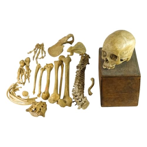A Victorian human half skeleton and skull. The skull prepare...